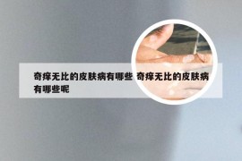 奇痒无比的皮肤病有哪些 奇痒无比的皮肤病有哪些呢