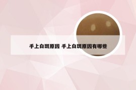 手上白斑原因 手上白斑原因有哪些