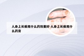 人身上长癣用什么药效果好 人身上长癣用什么药膏