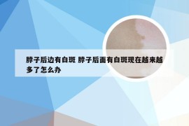 脖子后边有白斑 脖子后面有白斑现在越来越多了怎么办