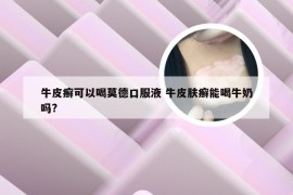 牛皮癣可以喝莫德口服液 牛皮肤癣能喝牛奶吗?