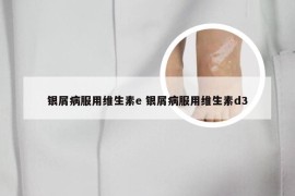 银屑病服用维生素e 银屑病服用维生素d3