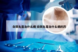 白斑丸是治什么病 白斑丸是治什么病的药