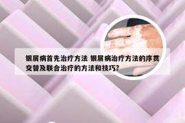 银屑病首先治疗方法 银屑病治疗方法的序贯交替及联合治疗的方法和技巧?