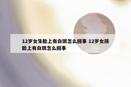 12岁女生脸上有白斑怎么回事 12岁女孩脸上有白斑怎么回事