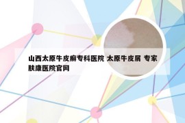 山西太原牛皮癣专科医院 太原牛皮屑 专家肤康医院官网