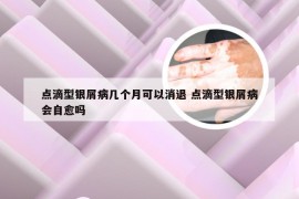 点滴型银屑病几个月可以消退 点滴型银屑病会自愈吗