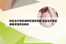 南昌治疗银屑病哪家值得信赖 南昌治疗银屑病哪家值得信赖的