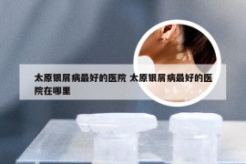 太原银屑病最好的医院 太原银屑病最好的医院在哪里