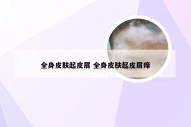 全身皮肤起皮屑 全身皮肤起皮屑痒