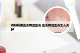 白颠疯用盖百霖遮盖液 盖百霖遮盖液怎么洗掉