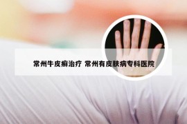 常州牛皮癣治疗 常州有皮肤病专科医院