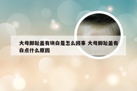 大母脚趾盖有块白是怎么回事 大母脚趾盖有白点什么原因