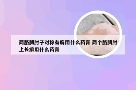 两胳膊肘子对称有癣用什么药膏 两个胳膊肘上长癣用什么药膏