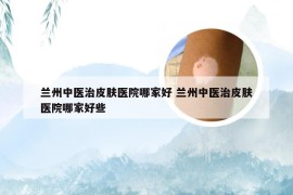 兰州中医治皮肤医院哪家好 兰州中医治皮肤医院哪家好些