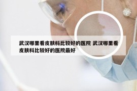 武汉哪里看皮肤科比较好的医院 武汉哪里看皮肤科比较好的医院最好