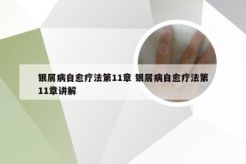 银屑病自愈疗法第11章 银屑病自愈疗法第11章讲解