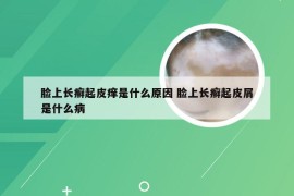 脸上长癣起皮痒是什么原因 脸上长癣起皮屑是什么病