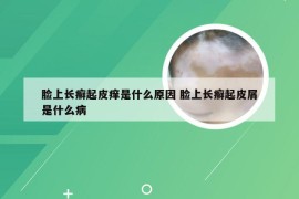 脸上长癣起皮痒是什么原因 脸上长癣起皮屑是什么病