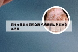 很多女性乳房周围白斑 乳房周围白色斑点怎么回事