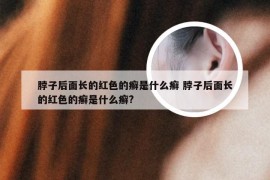 脖子后面长的红色的癣是什么癣 脖子后面长的红色的癣是什么癣?