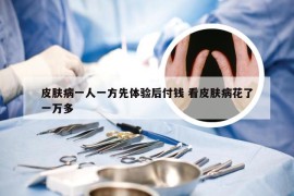 皮肤病一人一方先体验后付钱 看皮肤病花了一万多