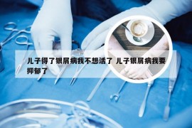 儿子得了银屑病我不想活了 儿子银屑病我要抑郁了