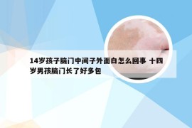 14岁孩子脑门中间子外面白怎么回事 十四岁男孩脑门长了好多包