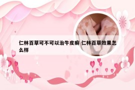 仁林百草可不可以治牛皮癣 仁林百草效果怎么样