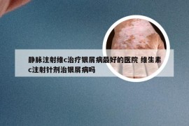 静脉注射维c治疗银屑病最好的医院 维生素c注射针剂治银屑病吗