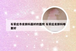 石家庄市皮肤科最好的医院 石家庄皮肤科哪里好