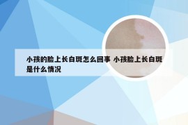 小孩的脸上长白斑怎么回事 小孩脸上长白斑是什么情况