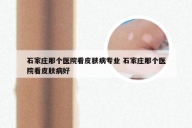 石家庄那个医院看皮肤病专业 石家庄那个医院看皮肤病好