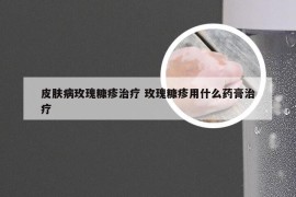 皮肤病玫瑰糠疹治疗 玫瑰糠疹用什么药膏治疗