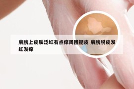 肩膀上皮肤泛红有点痒周围褪皮 肩膀脱皮发红发痒