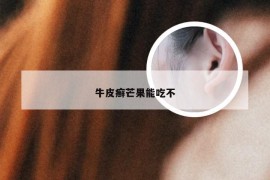 牛皮癣芒果能吃不
