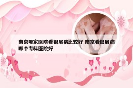 南京哪家医院看银屑病比较好 南京看银屑病哪个专科医院好