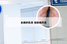 去癣的乳膏 祛除癣药膏