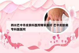 四川巴中市皮肤科医院哪家最好 巴中皮肤病专科医医院