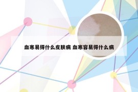 血寒易得什么皮肤病 血寒容易得什么病