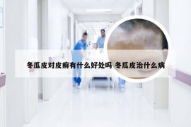 冬瓜皮对皮癣有什么好处吗 冬瓜皮治什么病