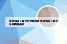 银屑病关节炎会胸锁骨水肿 银屑病关节炎会导致胸骨痛吗