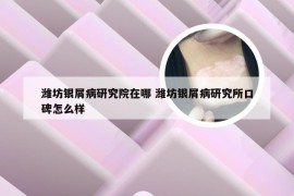 潍坊银屑病研究院在哪 潍坊银屑病研究所口碑怎么样