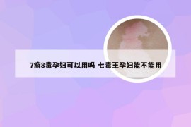 7癣8毒孕妇可以用吗 七毒王孕妇能不能用