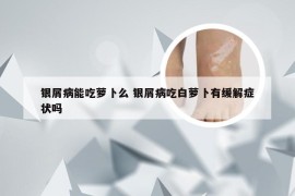 银屑病能吃萝卜么 银屑病吃白萝卜有缓解症状吗