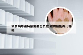 银屑病申请特病需要怎么做 银屑病能办门特吗