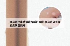 顺义治疗皮肤病最权威的医院 顺义这边有好的皮肤医院吗