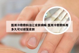 医用冷敷敷料治辽皮肤病嘛 医用冷敷敷料用多久可以修复皮肤