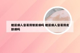 糖尿病人容易得银屑病吗 糖尿病人容易得皮肤病吗