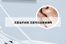 艾蒿治疗白斑 艾蒿可以治皮肤病吗